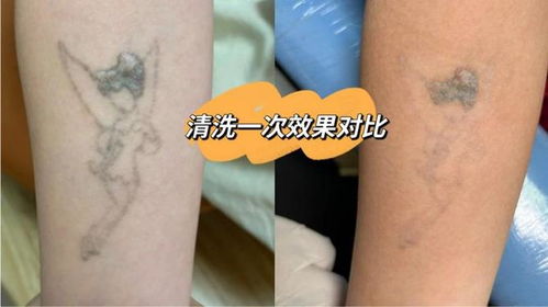 前世姻缘痣胳膊内侧图片(前世姻缘痣的传说)