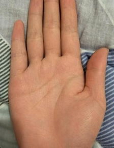 红痣定姻缘(红痣看相)