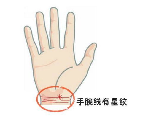 姻缘线太长(姻缘线会断吗)