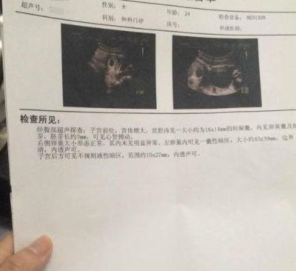 男子CT报告显示“子宫未见异常”