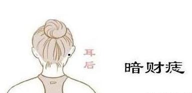 合和痣姻缘(和合痣相遇了)